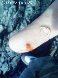 ¥Ò¥È¡Ê¼«Ê¬¡Ë